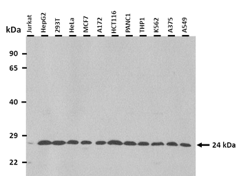 RPL15 Rabbit Polyclonal Antibody