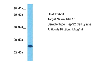 RPL15 Rabbit Polyclonal Antibody