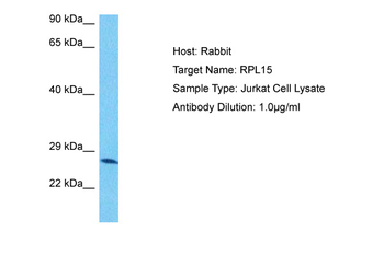 RPL15 Rabbit Polyclonal Antibody