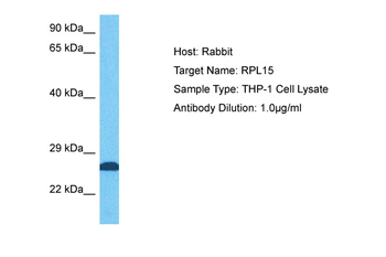 RPL15 Rabbit Polyclonal Antibody