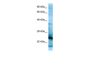 RPL15 Rabbit Polyclonal Antibody