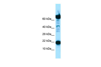 RPS11 Rabbit Polyclonal Antibody
