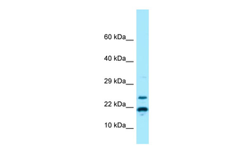 RPS11 Rabbit Polyclonal Antibody