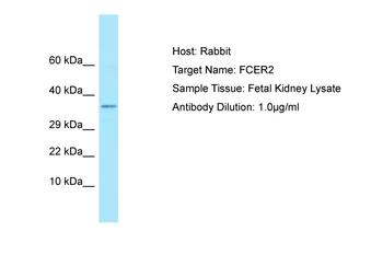 FCER2 Rabbit Polyclonal Antibody