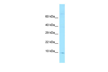 FKBP1A Rabbit Polyclonal Antibody