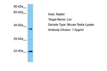LXN Rabbit Polyclonal Antibody