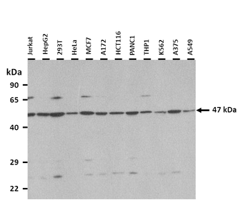 SNX6 Rabbit Polyclonal Antibody