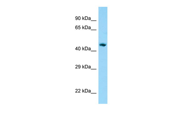 AP1M1 Rabbit Polyclonal Antibody