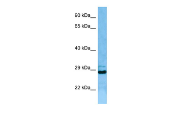 EIF3J Rabbit Polyclonal Antibody