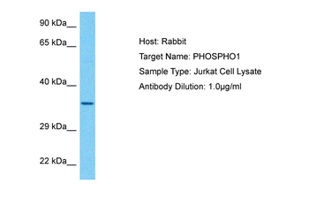 PHOSPHO1 Rabbit Polyclonal Antibody
