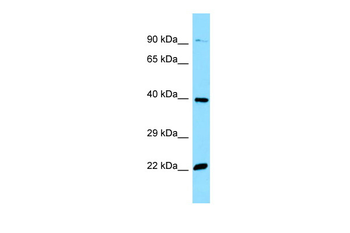 OR51E2 Rabbit Polyclonal Antibody
