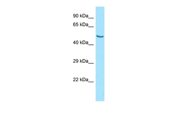 SCTR Rabbit Polyclonal Antibody