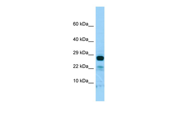 IL22RA2 Rabbit Polyclonal Antibody