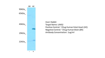 LIMS2 Rabbit Polyclonal Antibody