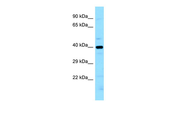 LIMS2 Rabbit Polyclonal Antibody