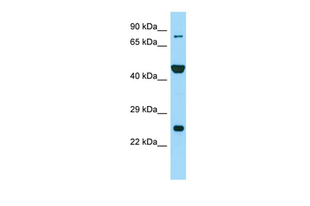 PADI6 Rabbit Polyclonal Antibody
