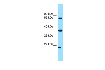 SLC13A1 Rabbit Polyclonal Antibody