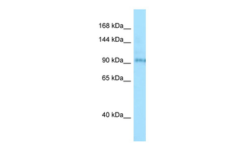 BBS9 Rabbit Polyclonal Antibody