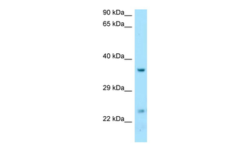 DTD1 Rabbit Polyclonal Antibody