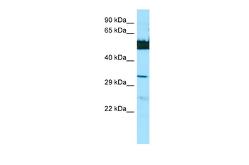 LGSN Rabbit Polyclonal Antibody