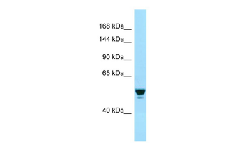 RABGAP1 Rabbit Polyclonal Antibody