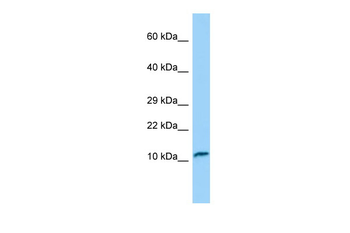 TNNC2 Rabbit Polyclonal Antibody