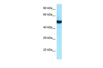 TUBB2B Rabbit Polyclonal Antibody