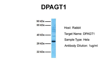 DPAGT1 Rabbit Polyclonal Antibody