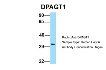 DPAGT1 Rabbit Polyclonal Antibody