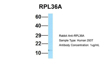 RPL36AL Rabbit Polyclonal Antibody