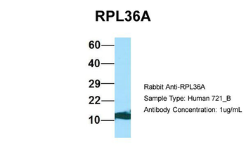 RPL36AL Rabbit Polyclonal Antibody