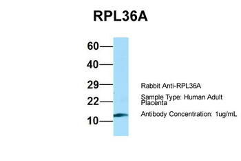 RPL36AL Rabbit Polyclonal Antibody