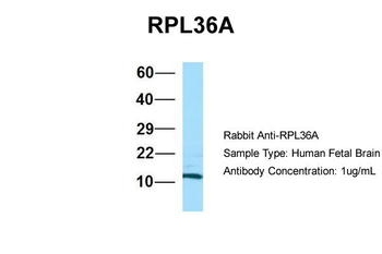 RPL36AL Rabbit Polyclonal Antibody