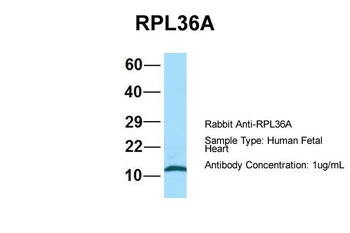 RPL36AL Rabbit Polyclonal Antibody
