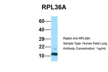 RPL36AL Rabbit Polyclonal Antibody