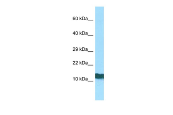 RPL36AL Rabbit Polyclonal Antibody