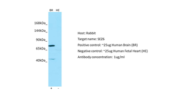 SEZ6 Rabbit Polyclonal Antibody
