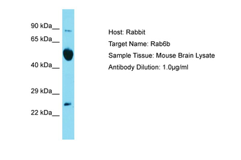 Rab6b Rabbit Polyclonal Antibody