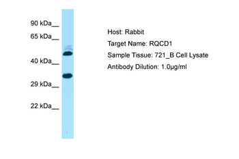 CNOT9 Rabbit Polyclonal Antibody