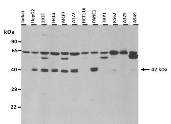 S1PR3 Rabbit Polyclonal Antibody