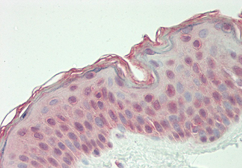 BICRA Rabbit Polyclonal Antibody