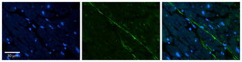 KRT8 Rabbit Polyclonal Antibody