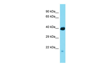 RCBTB2 Rabbit Polyclonal Antibody