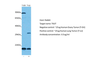 TIGIT Rabbit Polyclonal Antibody