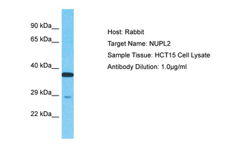 NUPL2 Rabbit Polyclonal Antibody
