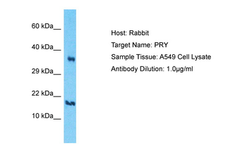 PRY Rabbit Polyclonal Antibody