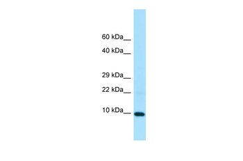 LSM5 Rabbit Polyclonal Antibody