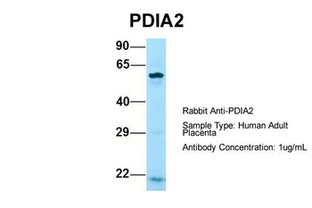 PDIA2 Rabbit Polyclonal Antibody