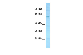 PDIA2 Rabbit Polyclonal Antibody
