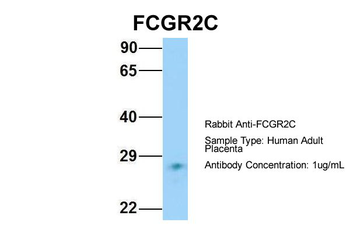 FCGR2C Rabbit Polyclonal Antibody